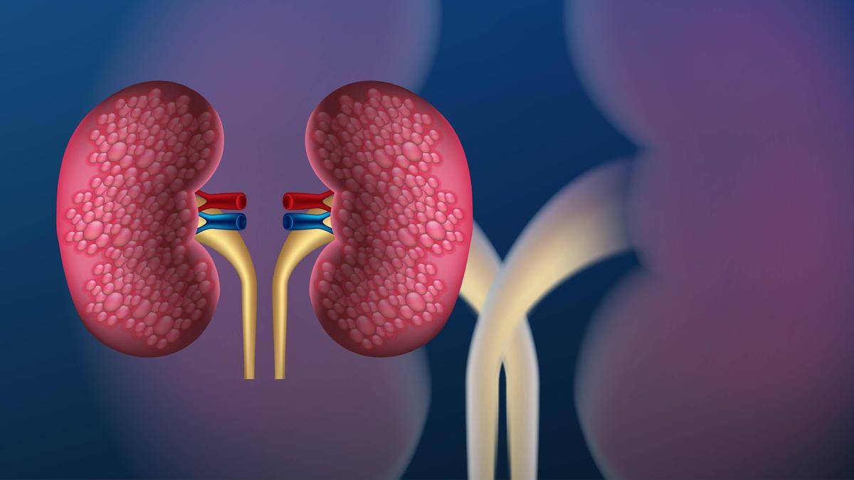 Bengaluru-based hospital performs pediatric kidney transplant through donor swap between two families